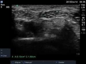 CTS with measurement