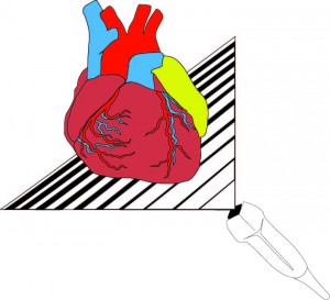 Cardiac Abscess Diag 2