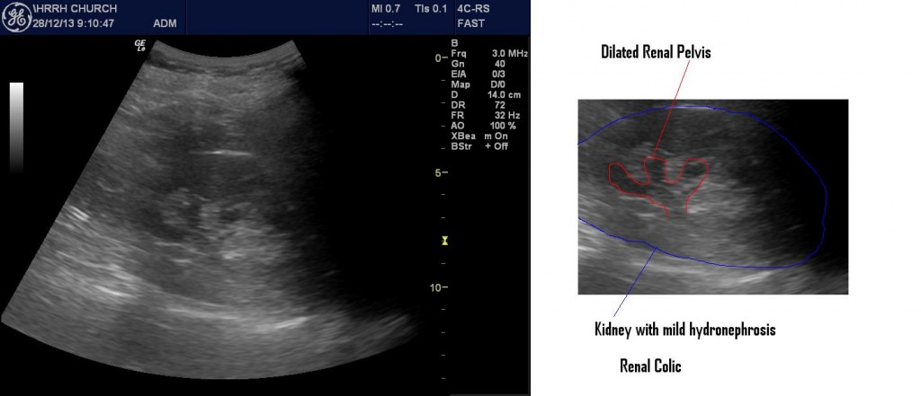 H682964RHydro