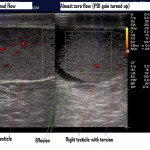 Scrotal ultrasound: it’s what’s inside that matters