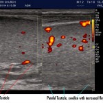 Scrotal U/S-infection