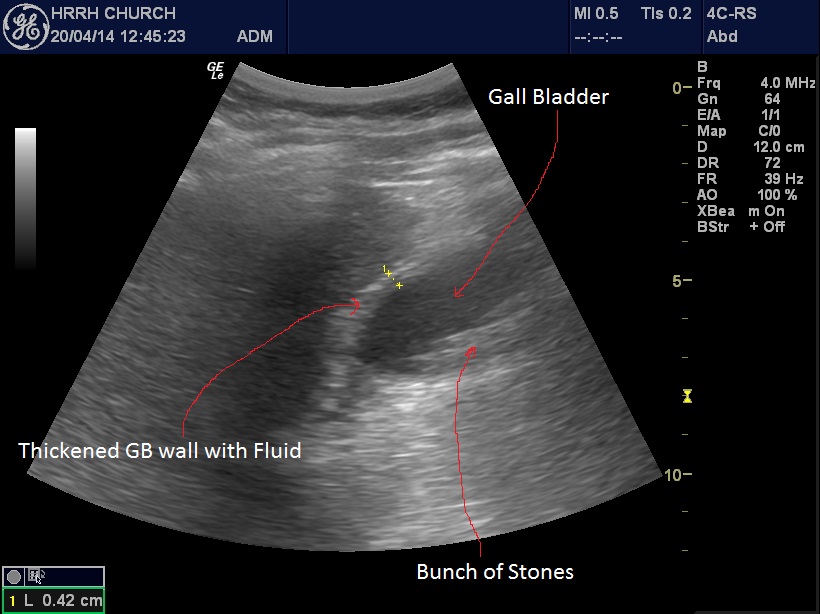 Weird Symptoms : POCUS Blog