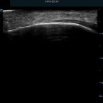 Abscesses, hematomas, and cellulitis, oh my!